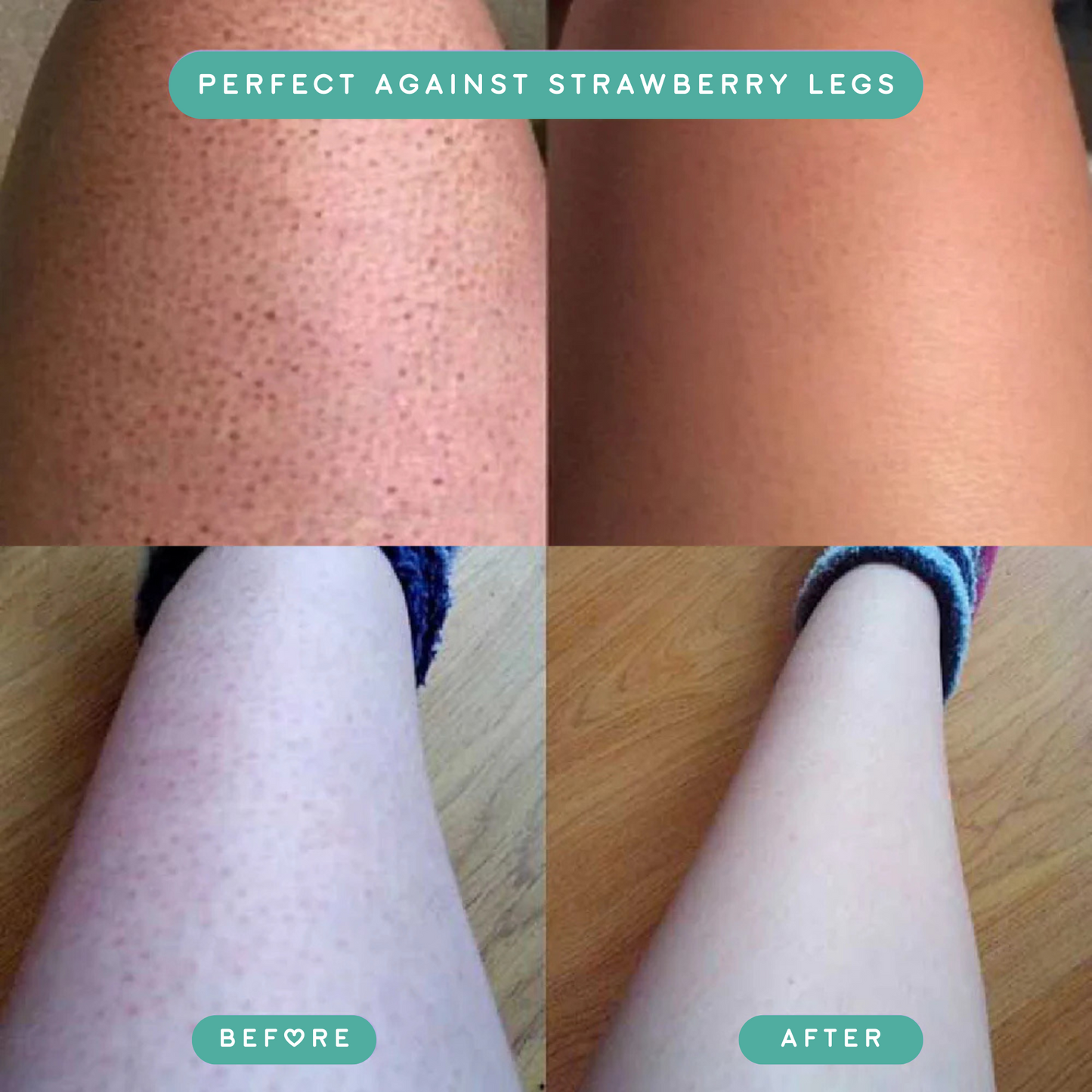 Swish™ Crystal Hair Eraser 2.0